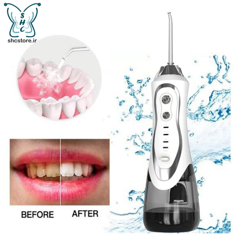 واترجت_همراه_دندان_گیت_مت_لو_ اساچسی